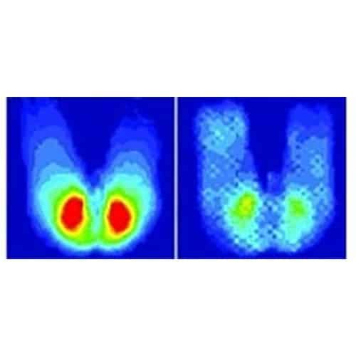 EquaGel Protector - Image 5