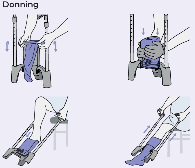 Melany Compression Garment Applicator - Image 5